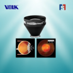 Area Centralise Laser Lens Volk USA - Image 2